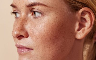soin PTB pigmentation