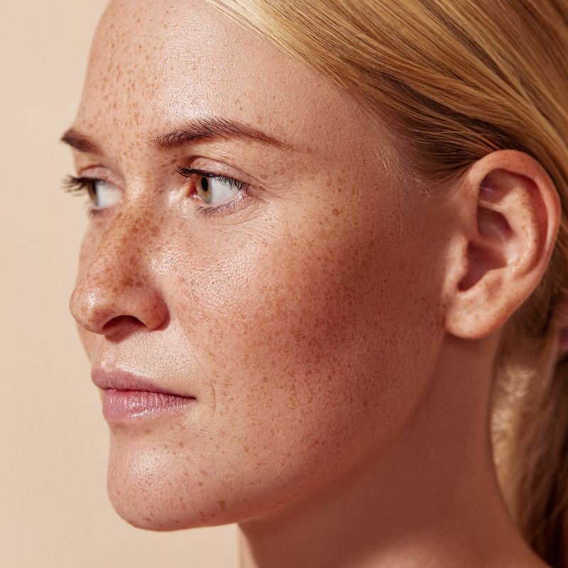 soin PTB pigmentation soin PTB pigmentation