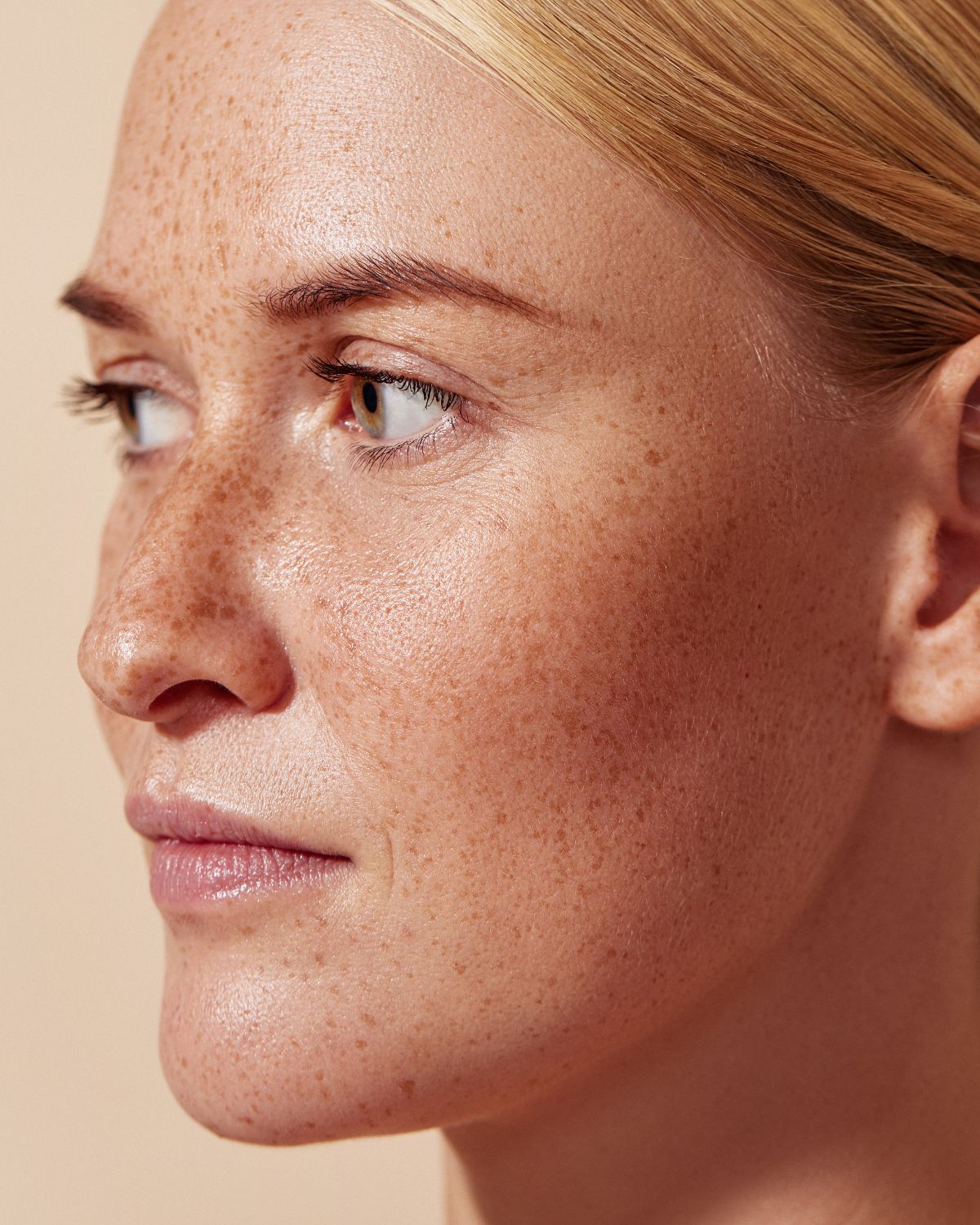soin pigmentation post acte esthetique soin pigmentation post acte esthétique